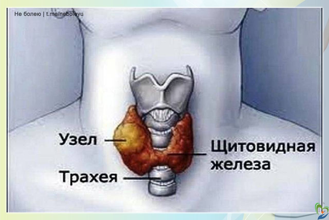 Варикоз Жить Здорово Щитовидная Железа