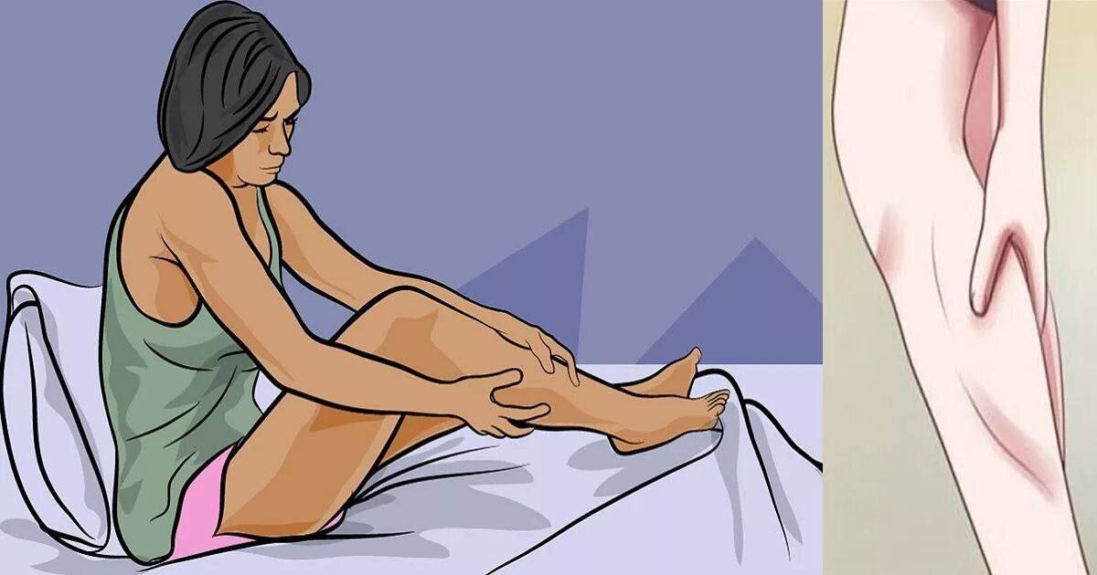 Судороги ног причина и что делать ночью. Синдром беспокойных ног. Ночные мышечные судороги.